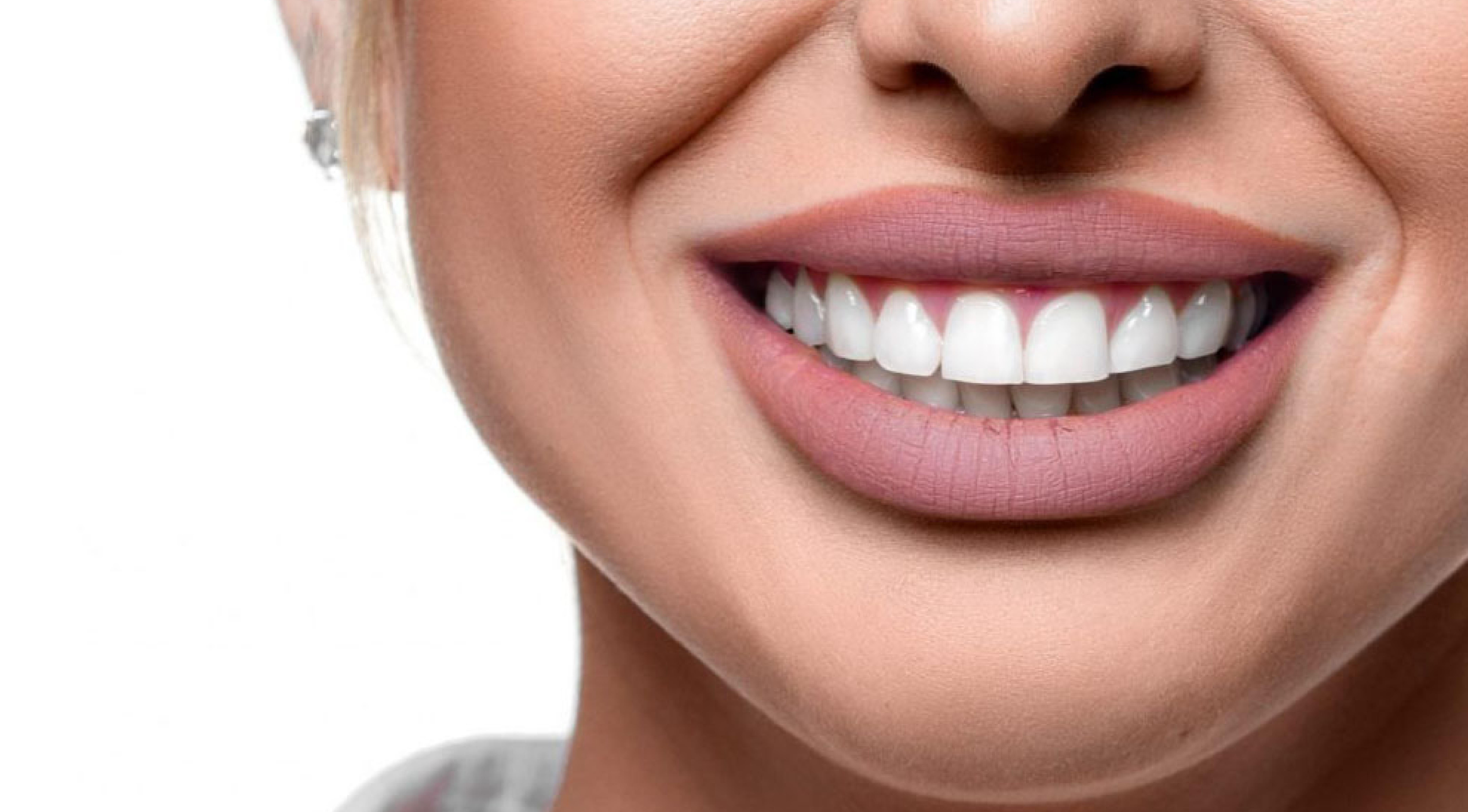 ابتسامة هوليوود